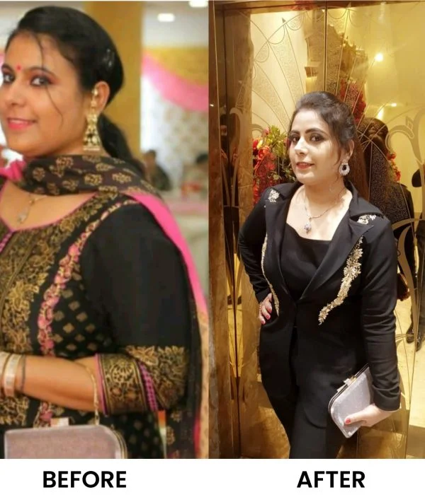 Before After Diet n Cure