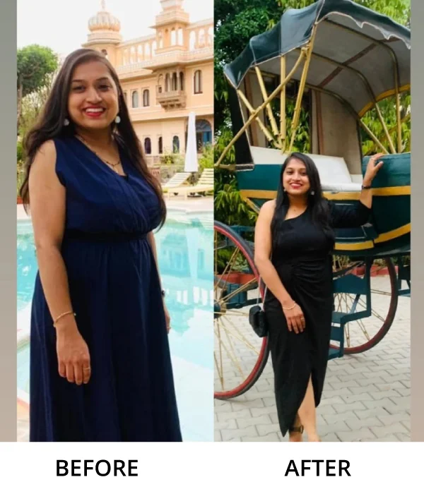 Before After Diet n Cure