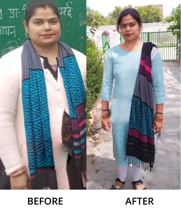 Before After Diet n Cure