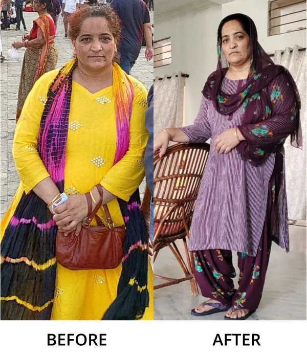 Before After Diet n Cure