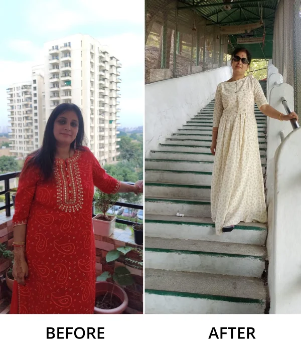 Before After Diet n Cure