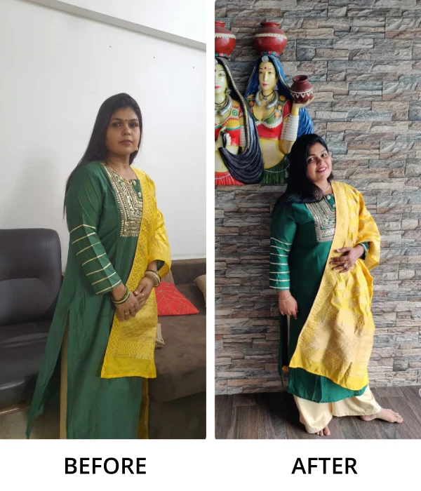Before After Diet n Cure