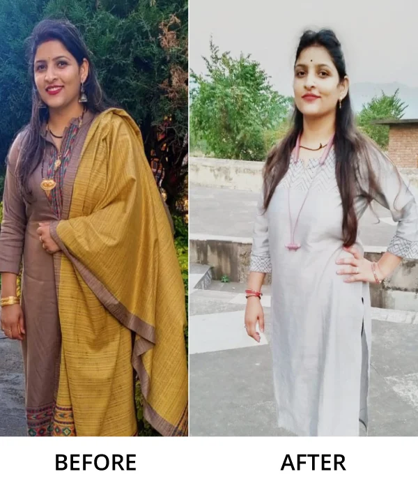 Before After Diet n Cure