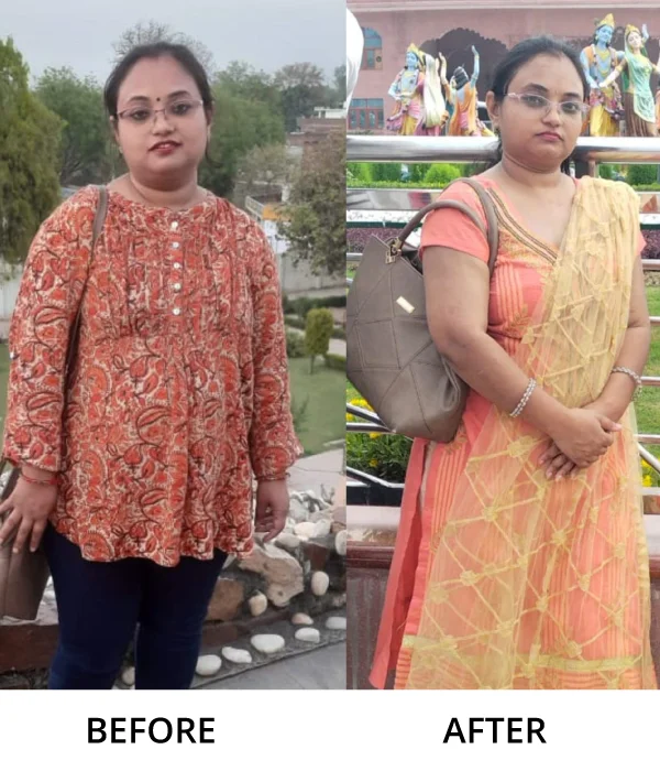 Before After Diet n Cure