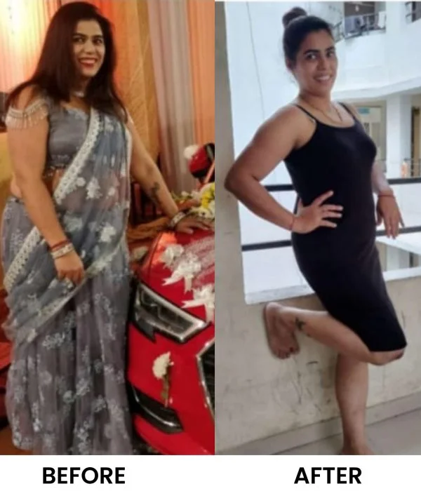 Before After Diet n Cure