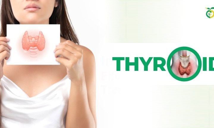 Thyroid patients