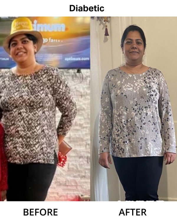 Kinnari-Rana-lost-with-weight-with-diabetes_